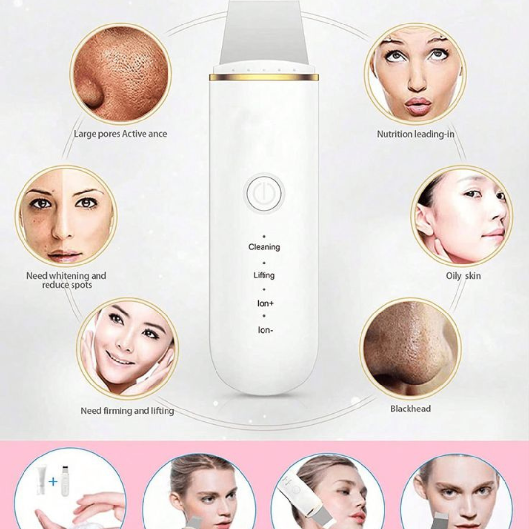 ANLAN Ultrasonic Blackhead Remover and Exfoliator
